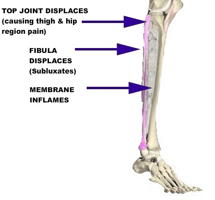 Hip and Leg Pain